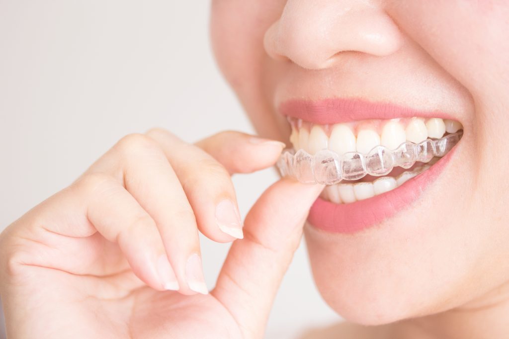 Teeth Straightening | Tower House Dental Clinic